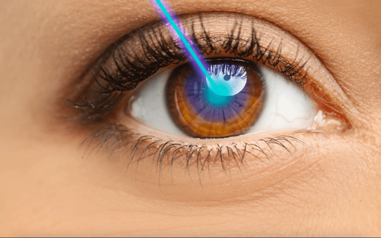 Lasik Eye Surgery Right Option