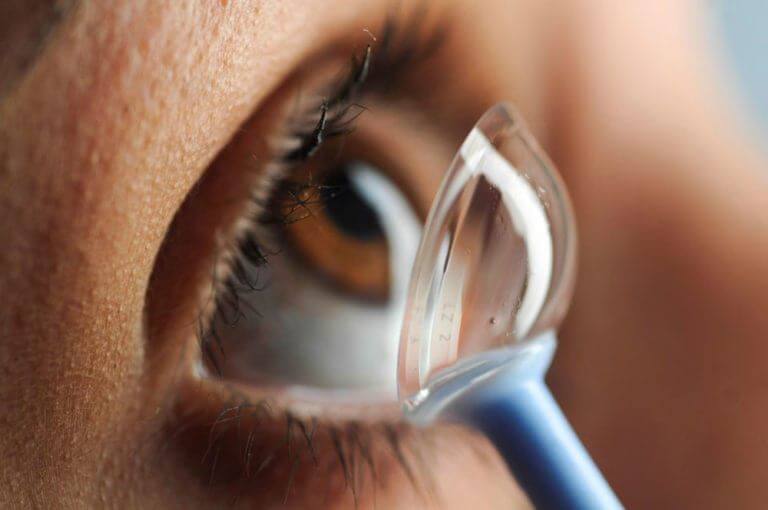 Scleral Lenses