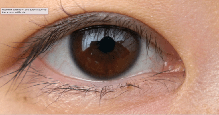 Lasik Eye Surgery