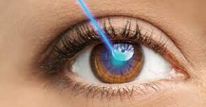 Lasik Fix Misalignment