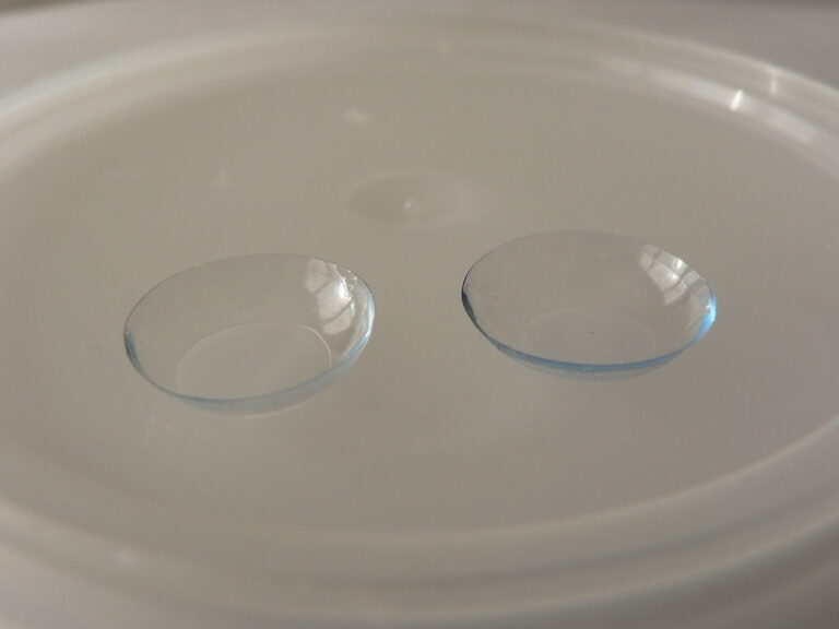 Contact Lenses After Lasik Surgery