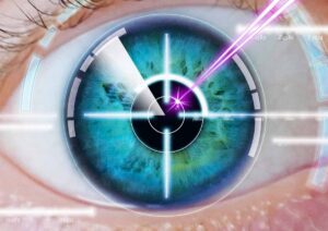 Reasons to Get LASIK Surgery