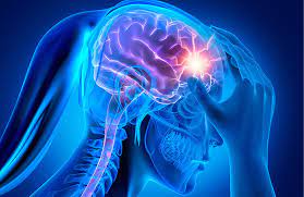 Lasik Surgery Helps Migraines
