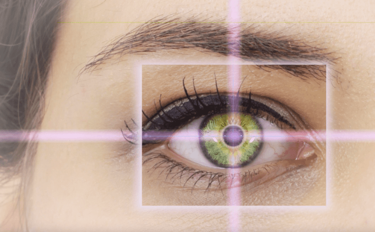LASIK Surgery Improved Your Life
