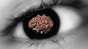 Can Lasik Surgery Affect The Brain
