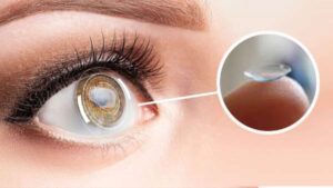 Stop Wearing Contacts Before Lasik