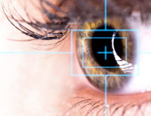 Can A Person With Cylindrical Power Contact Lenses Have LASIK