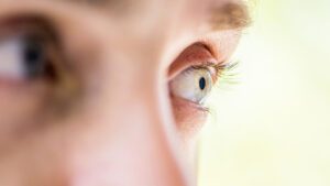 Can LASIK Fix Blindness
