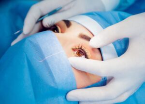 Is SMILE Surgery Permanent