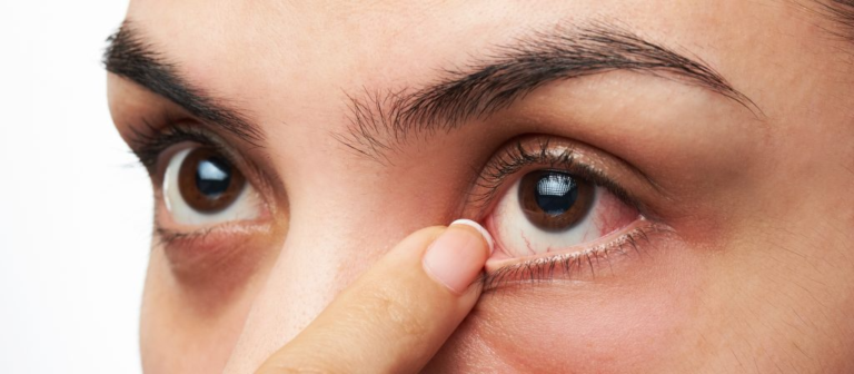 Side Effects Of Lasik Eye Surgery