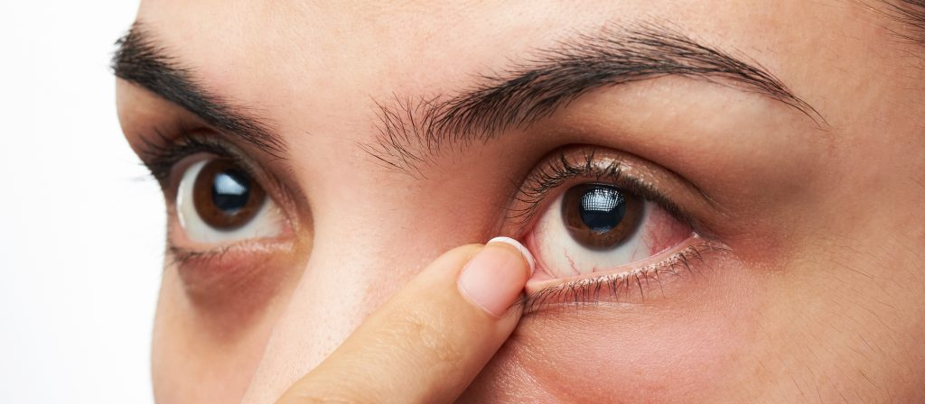 How to Get Rid of Puffy Eyes  Will Vision and Lasik Centers