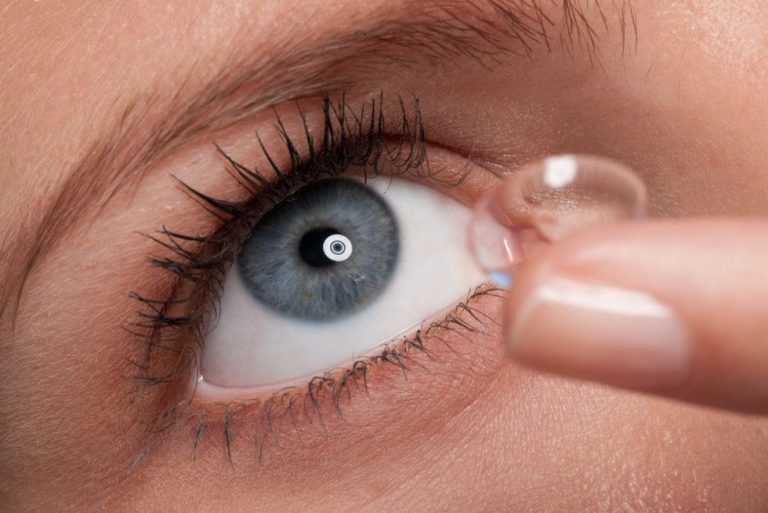 which is better contact lenses or lasik
