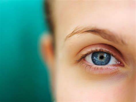 Squint eye treatment without surgery