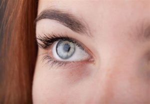 how long after lasik can i play golf