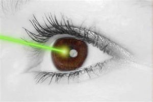 should i avoid the sun after lasik