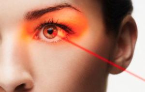 Is LASIK surgery allowed in banking