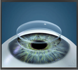 are blood tests taken before lasik