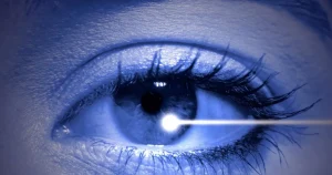 Can I have laser eye surgery with a squint