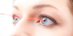 Is Lasik Surgery Allowed in SSC CPO?