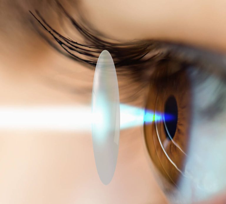 is silk eye surgery safe
