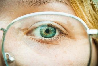 how to take care of your eyes after smile pro eye surgery