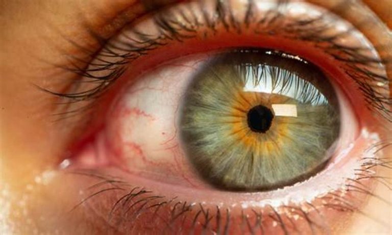 does silk eye surgery hurt