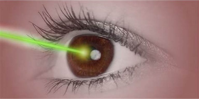 can i cook after silk eye surgery