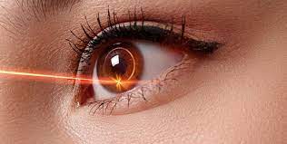 what is lasik surgery in hindi
