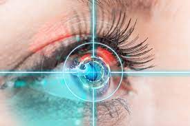 Minimum Corneal Thickness for Smile