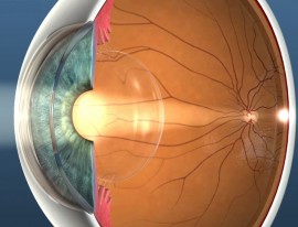 can lasik flap reopen