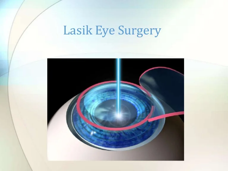 Lasik Eye Surgery Cost With Insurance
