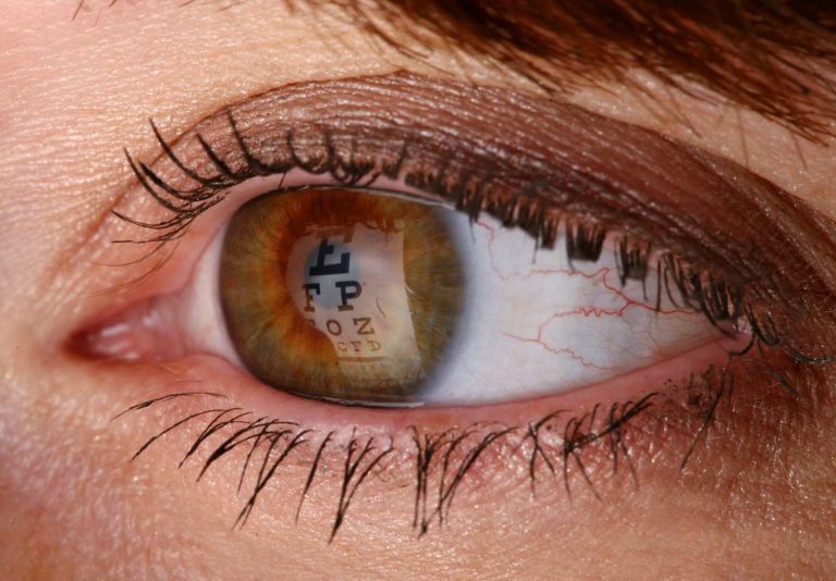 A person holding their eye after accidentally getting water in it post-LASIK surgery.