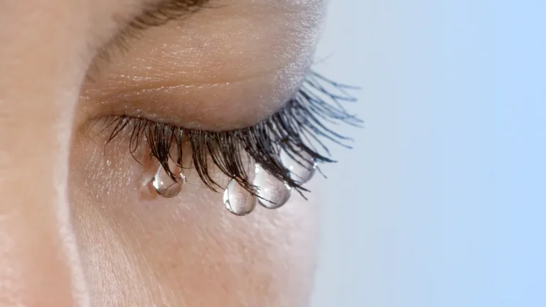 A person rubbing their eyes with a tissue due to excessive tearing after Lasik surgery.