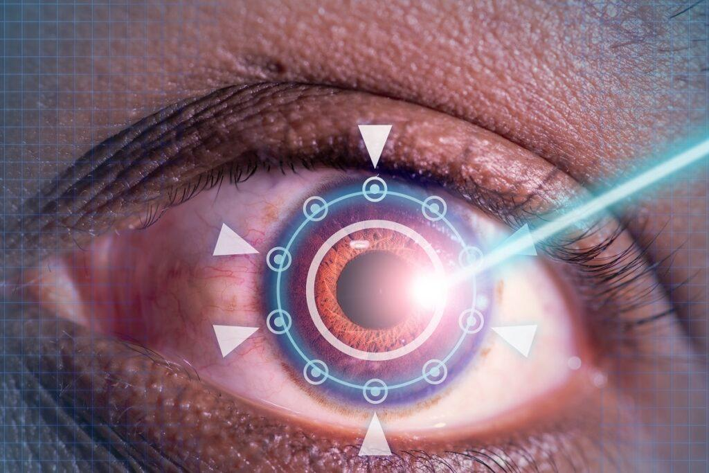Can Lasik Surgery Be Repeated?