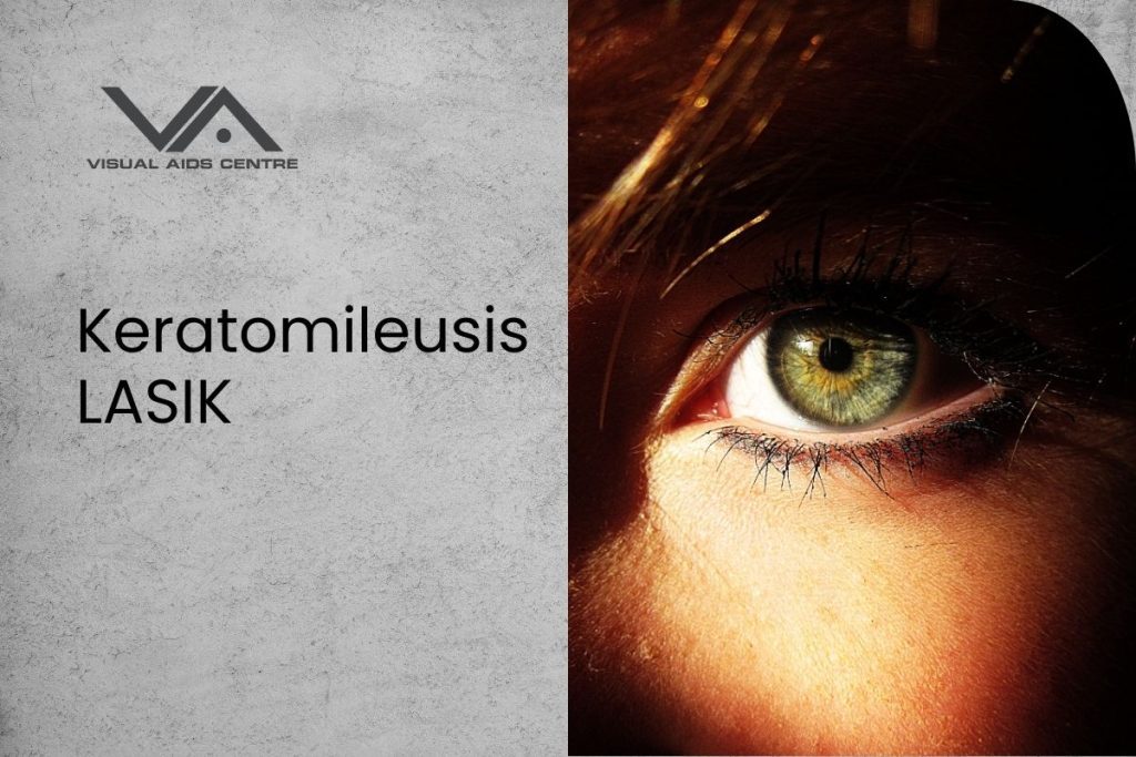 Keratomileusis Lasik: Achieving Clearer Vision with Precision