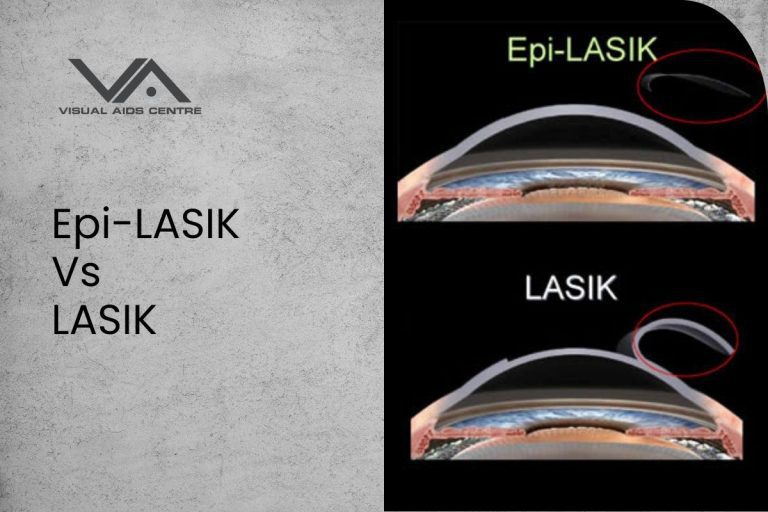 Epi-lasik Vs Lasik