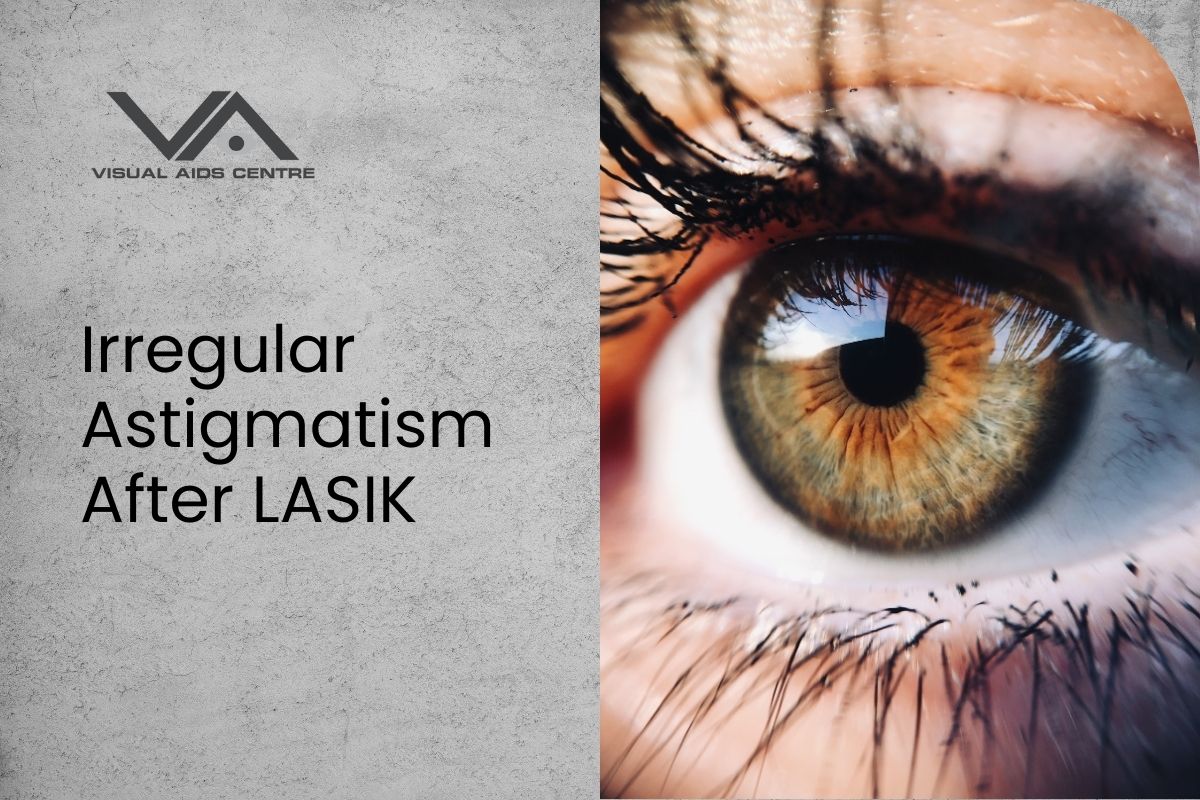 Stunning If I Have Astigmatism Can I Get Lasik Photo in HD Stunning If I Have Astigmatism Can I Get Lasik Photo in HD