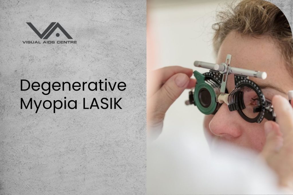 Degenerative Myopia LASIK