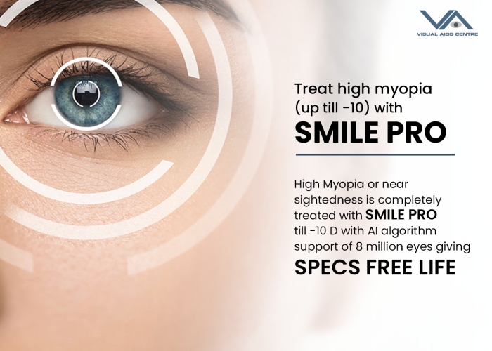 Advantages of Smile PRO